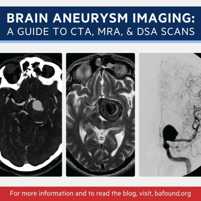 Not sure which imaging is best for detecting brain aneurysms?  Our latest blog breaks down CTA, MRA, and DSA, explaining their strengths, limitations, and how they guide treatment. Get informed and navigate  options confidently. Read more, https://www.bafound.org/blog/navigating-imaging-options-for-brain-aneurysms/